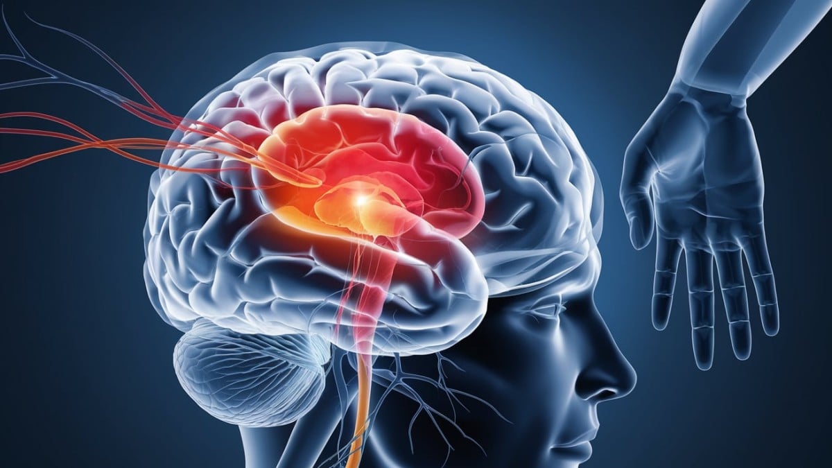 Cerveau en transparence AVC
